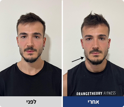 Group 1000002546 (1)